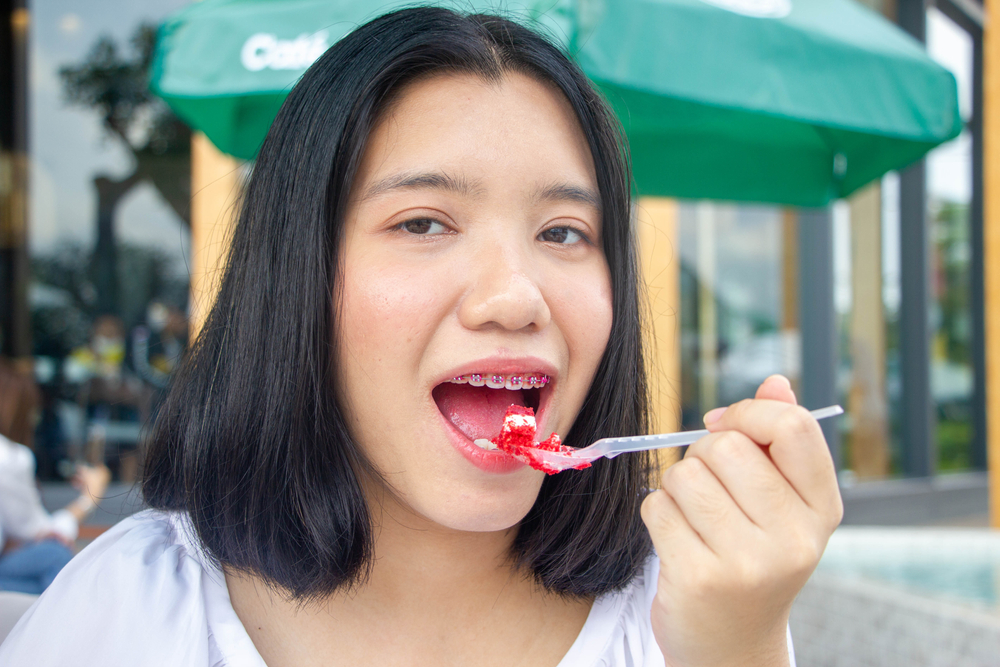 CARAMELOS Que Puedes Comer Con Brackets