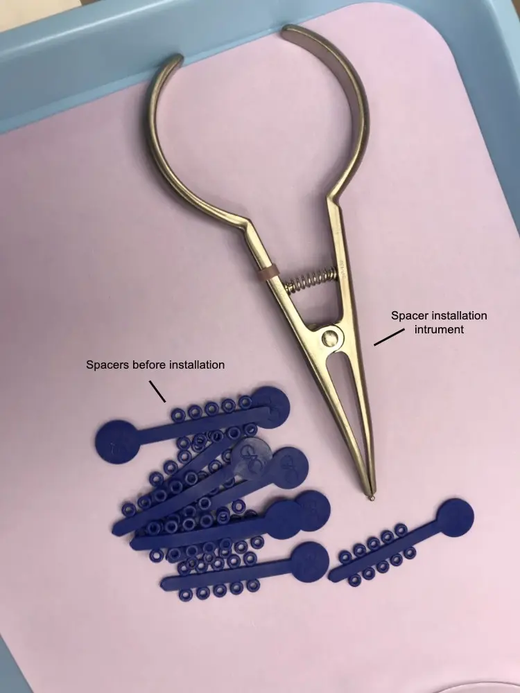 Spacers and Instrument for Braces