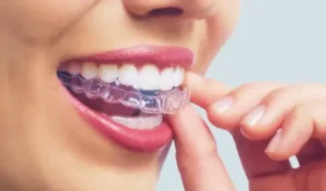 ¿PUEDES usar Invisalign con coronas?