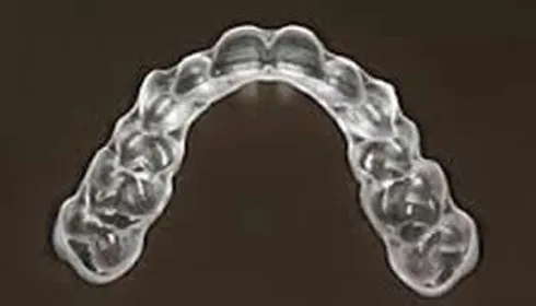 WHAT IS THE Clear Transparent Plastic Retainers (Removable)